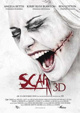 Scar 3D